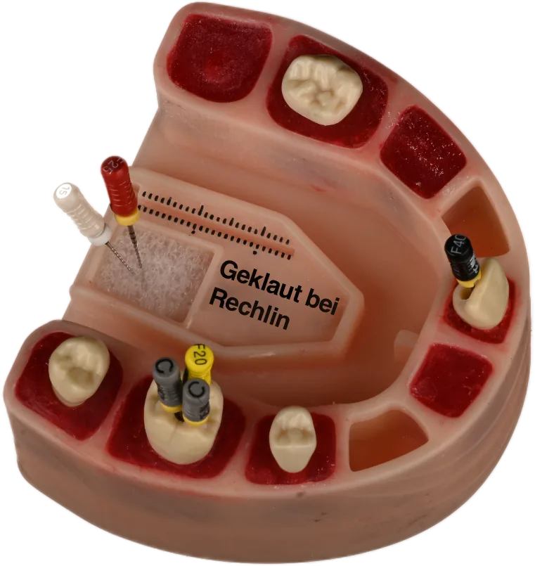 The eduModel: a printed jaw with natural teeth and endo files in place
